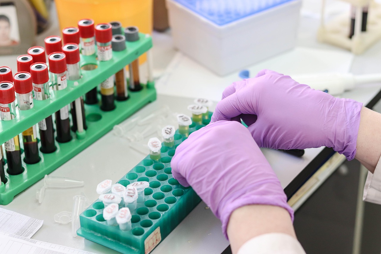 laboratory, medical, medicine, hand, research, lab, test, doctor, equipment, scientist, woman, chemistry, science, hospital, experiment, person, technician, technology, healthcare, working, health, tube, work, research lab, blood samples, laboratory, laboratory, laboratory, laboratory, laboratory, lab, lab, lab, scientist